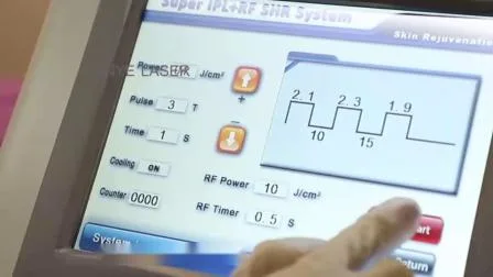 美容機器美容レーザー IPL 除去顔老化スポット YAG RF マシンレーザー付き